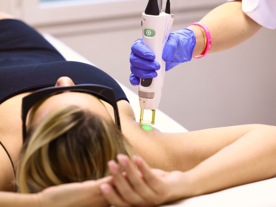 Epilation Laser