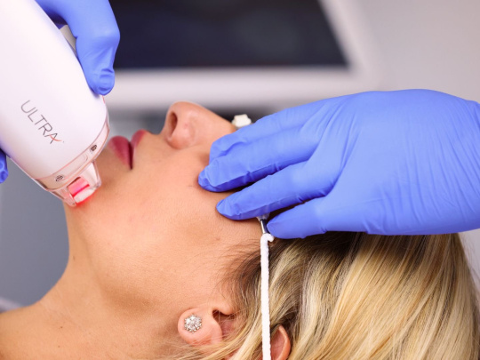 Laser LaseMD Ultra